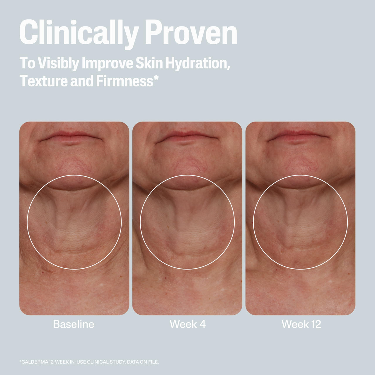 Cetaphil Skin Activator Hydrating & Firming Body Cream 12oz, Mandelic Acid (AHA) and Centella Asiatica (CICA) Cream, Hydrates and Firms Aging Skin, Anti-Aging Skincare, 12 oz