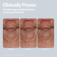 Thumbnail for Cetaphil Skin Activator Hydrating & Firming Body Cream 12oz, Mandelic Acid (AHA) and Centella Asiatica (CICA) Cream, Hydrates and Firms Aging Skin, Anti-Aging Skincare, 12 oz