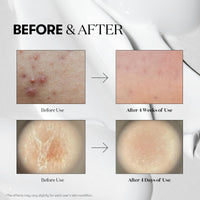 Thumbnail for VT COSMETICS CICA Reedle Shot 300, Advanced Night Exosome, Microneedling Serum, Centella Asiatica, Hyaluronic Acid, Propolis, Soft Skin, Regeneration, Glass Skin, Korean Skin Booster 1.69Fl Oz (50ml)