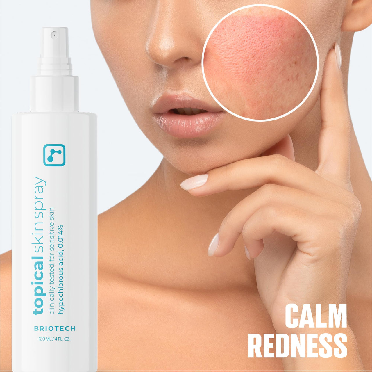 BRIOTECH Topical Skin Spray, Hypochlorous Acid Spray for Body & Face, Eyelid Cleanser, HOCl Facial Mist, Support Against Irritation and Redness, Packaging May Vary, 4oz (1 Pack)