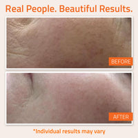 Thumbnail for YEOUTH Vitamin C Face Serum with Vitamin E and Hyaluronic Acid, Hydrating Vitamin C Serum for Face, Targets the Appearance of Dull Spots 2oz