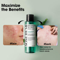 Thumbnail for SOME BY MI AHA BHA PHA 30 Days Miracle Toner – 5.07oz, 150ml – Korean Salicylic Acid Exfoliating Face Toner for All Skin Types – Daily Pore Care & Oil Control with 2% Niacinamide – Korean Skin Care