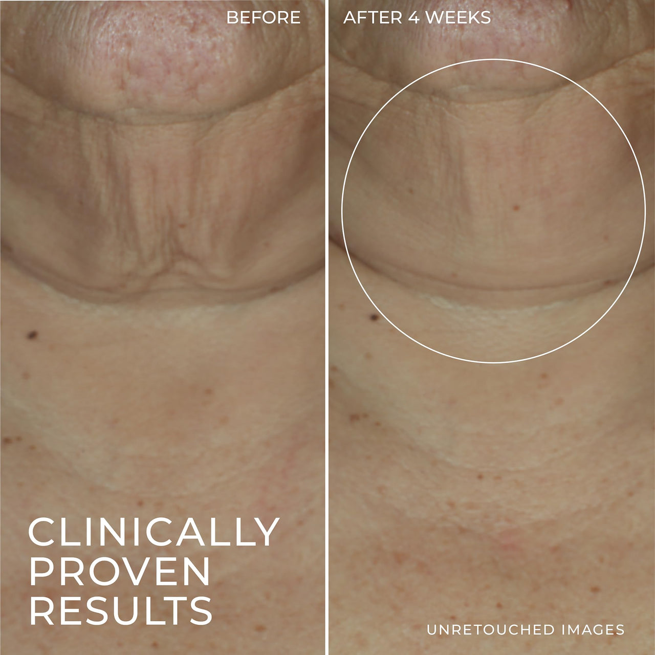 RoC Derm Correxion Retinol Firming Serum Stick with Antioxidants to Visibly Tighten and Firm Wrinkles and Laugh Lines 1.0 oz plus Retinol Eye Cream Packette