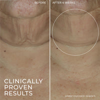 Thumbnail for RoC Derm Correxion Retinol Firming Serum Stick with Antioxidants to Visibly Tighten and Firm Wrinkles and Laugh Lines 1.0 oz plus Retinol Eye Cream Packette