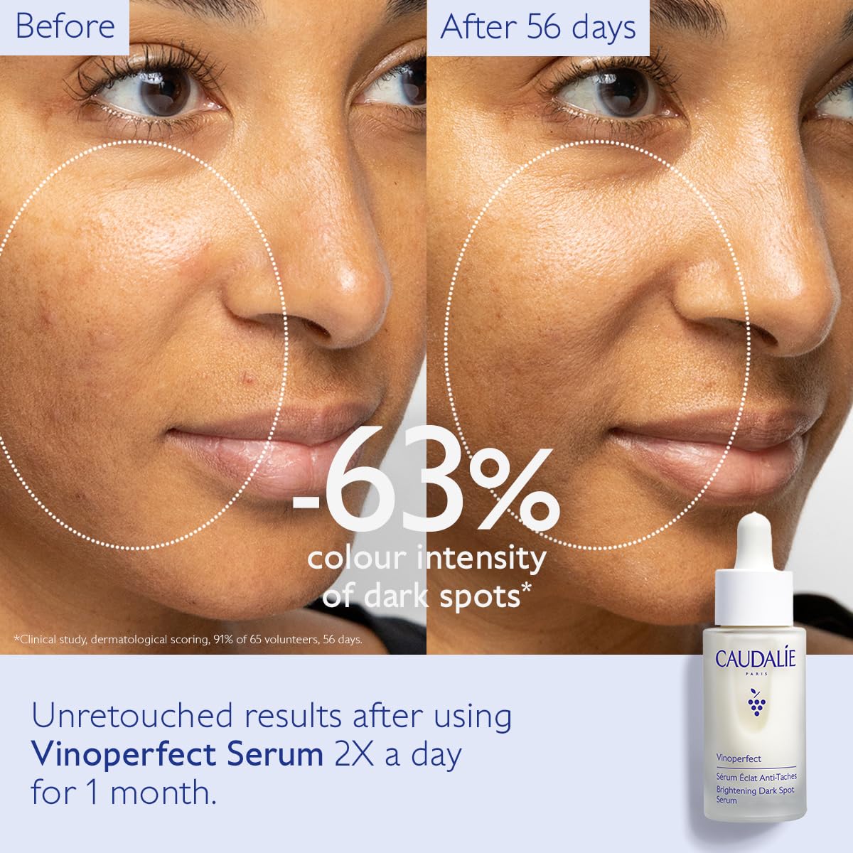 Caudalie Vinoperfect Brightening Dark Spot Serum, Dark Spot Corrector 62x More Effective than Vitamin C, Skin Brightening Serum with Viniferine, 1 Fl Oz