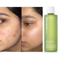Thumbnail for OLEHENRIKSEN Ole Henriksen Balancing Force Oil Control Toner 6.5 oz