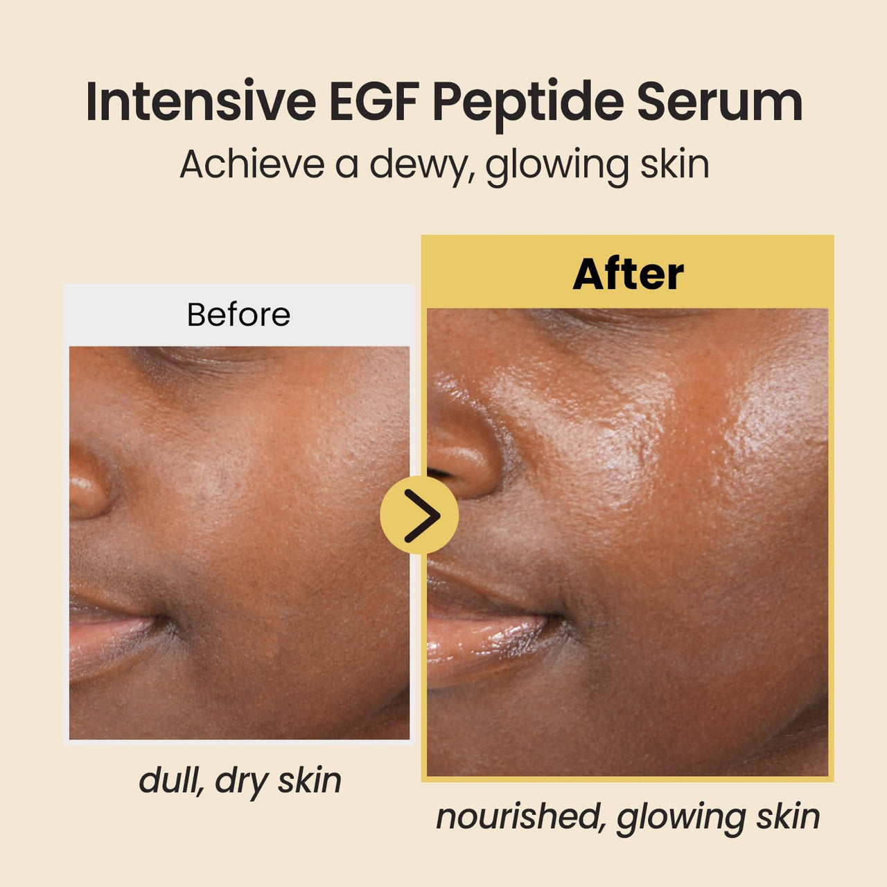 coxir INTENSIVE EGF PEPTIDES SERUM l EGF(Epidermal Growth Factor) Peptide Serum for Face – Korean Formula for Firm, Renew& Hydrated Skin – Facial Serum for Lines