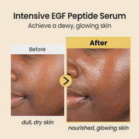 Thumbnail for coxir INTENSIVE EGF PEPTIDES SERUM l EGF(Epidermal Growth Factor) Peptide Serum for Face – Korean Formula for Firm, Renew& Hydrated Skin – Facial Serum for Lines