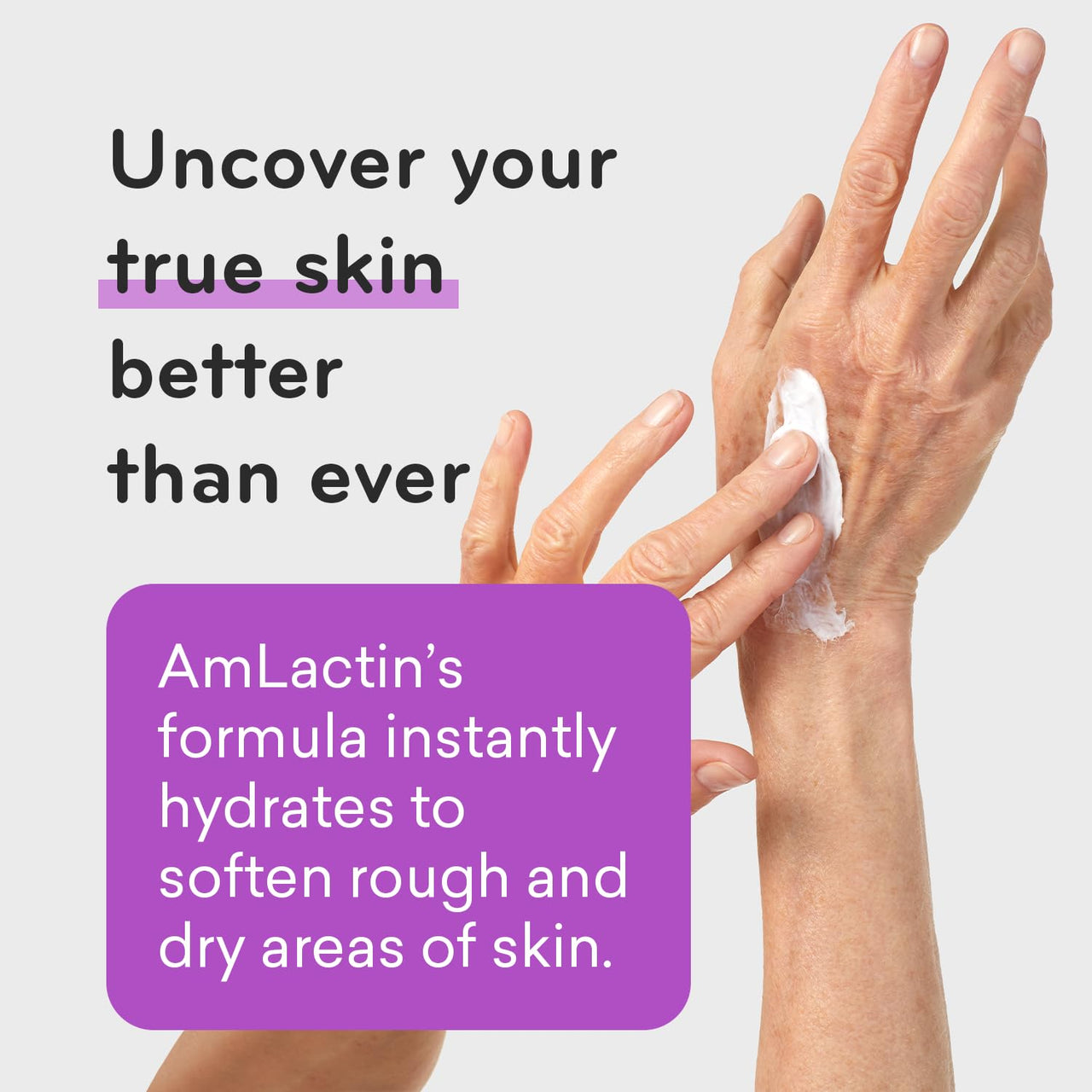 AmLactin Ultra Smoothing - Therapeutic Hand Cream for Dry Cracked Hands - No-Scrub Exfoliator and Moisturizer with 15% Lactic Acid AHA, 4.9 oz (Packaging May Vary)