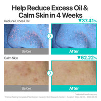 Thumbnail for numbuzin No.1 Serum | Pantothenic B5 Active Soothing Serum | Soothing, Hydrating | Pantothenic Acid, Niacinamide | Excess Oil Control, Reduces Breakouts, Acne | Oily, Acne-Prone Skin | 1.69 fl. oz.