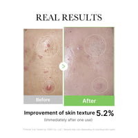 Thumbnail for Medicube Exosome Cica Tea Tree Ampoule for Sensitive Skin with Centella Asiatica help reduce redness and breakouts. Low-irritating, Moisturizing & Soothing Serum | Korean Skincare | 30ml