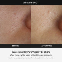 Thumbnail for Medicube Age-R ATS Air Shot - Microneedling Pore Tightening Skin Care Device for Enhanced Absorption, Pore Refinement, and Smoother Skin Texture - Exfoliation, Skin Rejuvenation - Korean Skin Care