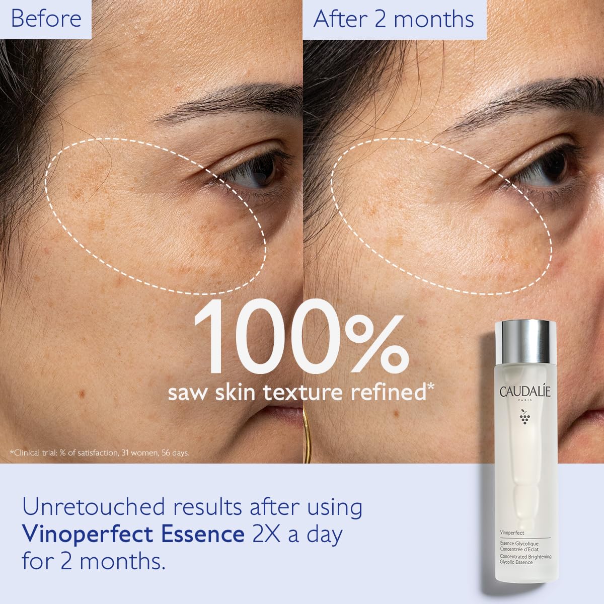 Caudalie Vinoperfect Brightening Essence, Glycolic Acid Toner (150 mL)