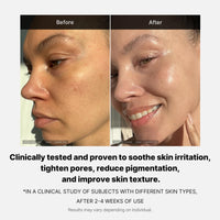 Thumbnail for medicube Triple Collagen Cream - Hydrating & Firming Moisturizer with Hyaluronic Acid, Premium Elastin, Shea Butter - Wrinkle Care & Boosts Elasticity - Korean Skincare, 1.69 oz