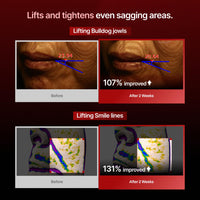 Thumbnail for MEDITHERAPY Wrinkle-fit Mask + Facial Roller, Collagen Mask, Lifting Sagging Skin, Hydrating, Improving Elasticity, Glass Skin, Korean Skincare
