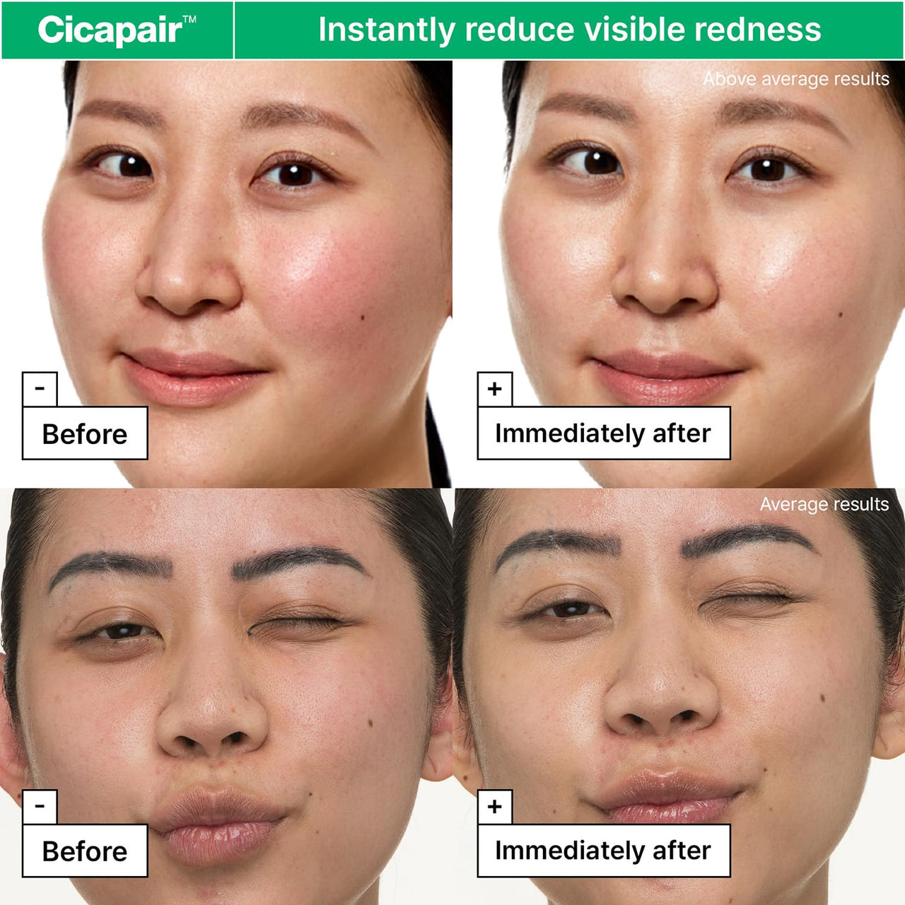 Dr.Jart+ Cicapair™ Sensitive Skin Face Moisturizer for Redness and Barrier Repair | Korean Skin Care, 1.69 Fl Oz