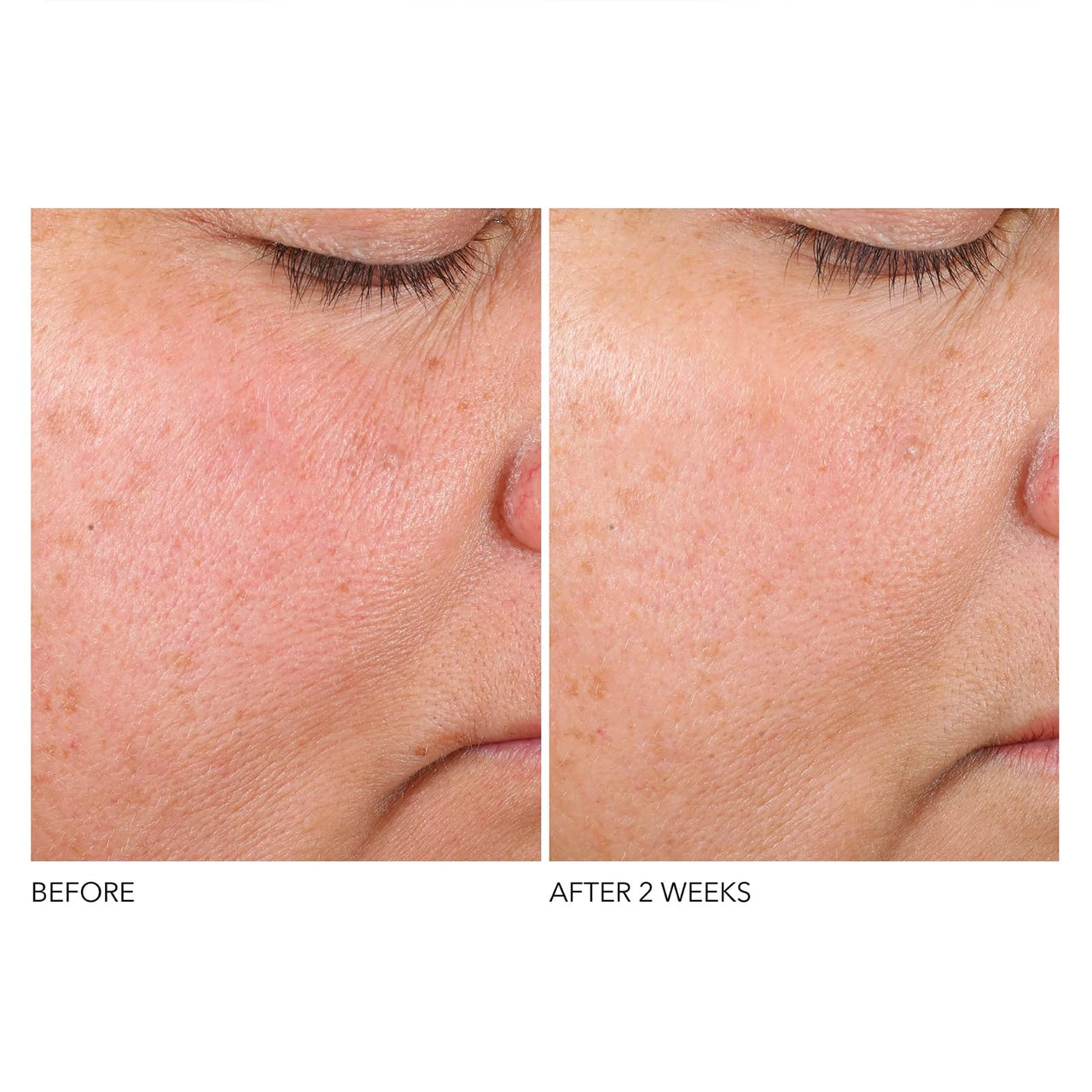 Dr. Dennis Gross Advanced Retinol + Ferulic Texture Renewal Serum – Anti-Aging Formula to Smooth Texture, Boost Radiance, and Minimize Fine Lines & Wrinkles, 1 oz