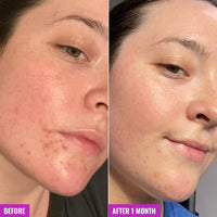 Thumbnail for Good Molecules Clarify and Cleanse Bar - Soap-Free Bar with Salicylic Acid BHA, Tea Tree, Kaolin Clay to Hydrate - Skincare for Face and Body