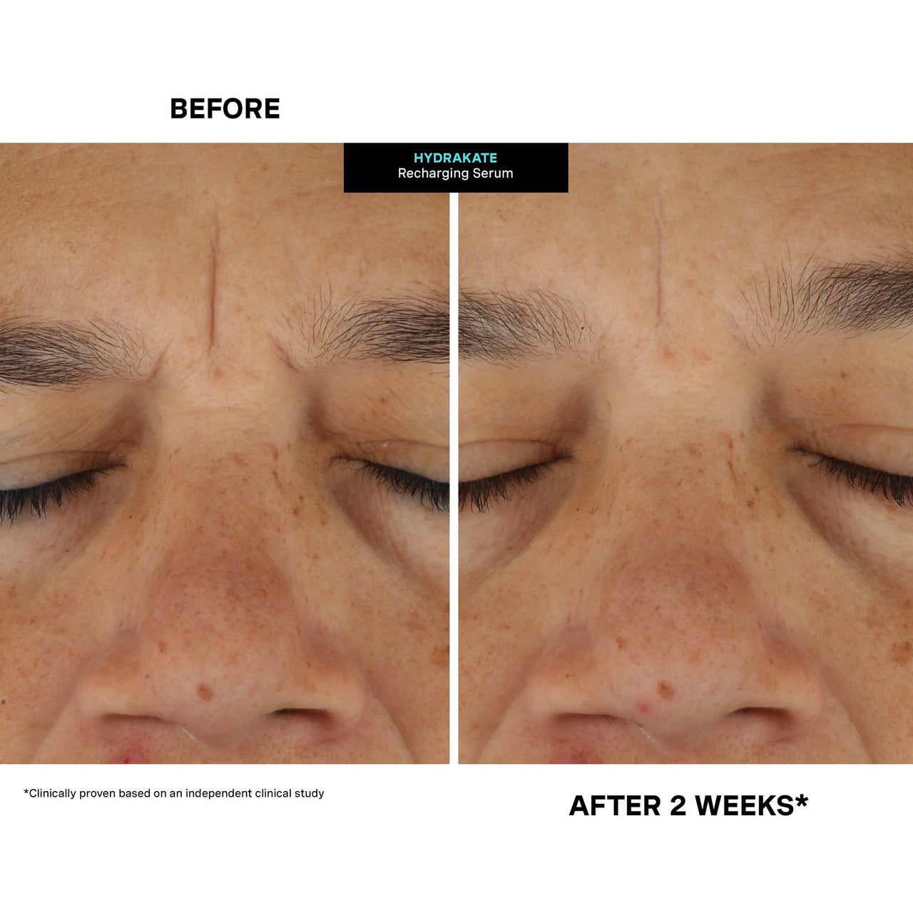 Kate Somerville HydraKate Recharging Hydration Serum – Skin-Quenching Dual-Weight Serum with Hyaluronic Acid for Hydrating, 1 Fl Oz