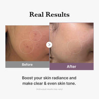 Thumbnail for medicube Age-R Glutathione Glow Milky Toner, Low-Irritation Double Layer Toner for Glass Glow Skin with Peptide, Even Skin Tone, Radiance, Hydration, Korean Skincare