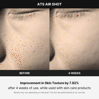 Thumbnail for Medicube Age-R ATS Air Shot - Microneedling Pore Tightening Skin Care Device for Enhanced Absorption, Pore Refinement, and Smoother Skin Texture - Exfoliation, Skin Rejuvenation - Korean Skin Care