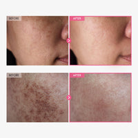 Thumbnail for TOSOWOONG Arbutin 7% + Tranexamic Acid 4% Cream, 70,000ppm Arbutin, 40,000ppm TXA, Niacinamide, Glutathione, Dark Spots, Freckle, Blemishes, Pigmentation, Korean Skin Care, 50ml, 1.69 fl.oz.