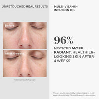 Thumbnail for Murad Multi-Vitamin Infusion Facial Oil - Absorbs Quickly and Moisturizes with Vitamins A-F - Hydration Anti-Aging Skin Treatment Backed by Science, 1.0 Oz