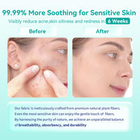 Thumbnail for Face Towels, 10