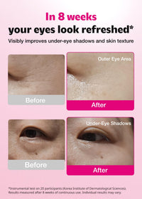 Thumbnail for ISOI Blemish Care Under Eye Patch for Dark Circles, Puffiness and Wrinkles, Hydrating Gel Eye Masks with Hyaluronic Acid & Bulgarian Rose Oil, Korean Skin Care (90 pcs, 3.17 oz)