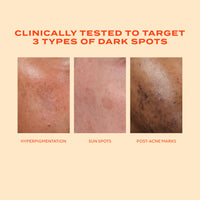 Thumbnail for Murad Rapid Dark Spot Correcting Serum - Advanced Anti-Aging Formula with Patented Resorcinol Technology, Tranexamic and Glycolic Acids for Hyperpigmentation, Dark Spots and Dull Skin - 1 Fl Oz