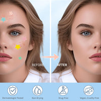 Thumbnail for QUSTERE Pimple Patches for Face, Hydrocolloid Acne Patches, Cute Star Zit Covers, Colorful Spot Stickers with Tea Tree, Salicylic Acid & Cica Oil| 3 Sizes (10mm, 12mm & 14mm) |200 Count