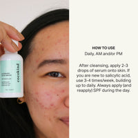 Thumbnail for Cocokind Postbiotic Acne Serum, Salicylic Acid Serum and BHA Liquid Exfoliant - Exfoliating, Brightening and Hydrating Serum