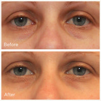 Thumbnail for Murad Vita-C Eyes Dark Circle Corrector – Environmental Shield Vitamin C Brightening Serum – Anti-Aging Treatment for Puffiness and Wrinkles, 0.5 Fl Oz