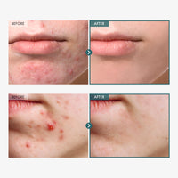 Thumbnail for TOSOWOONG Adenosine Cica Cream, 520,000ppm Centella Asiatica, Redness Reducing for Oily and Dry Skin Moisturizer, Barrier Cream with Niacinamide and Panthenol, Korean Skincare, 100ml, 3.38 fl. oz.