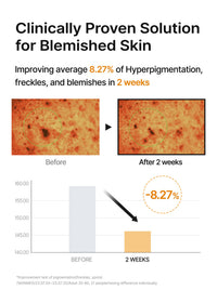 Thumbnail for celimax Pore+Dark Spot Brightening Pad | Exfoliating Peeling Pads for Enlarged Pores, with Hyaluronic Acid, Pore Minimizer, Non-Irritating, Hydrating, For Sensitive Skin (40 pads)