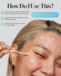 Thumbnail for Kate Somerville EradiKate 10% Sulfur & BHA Acne Treatment – FSA/HSA Acne Treatment for Face, Clinically Formulated Pimple Cream Spot Treatment, Medicated Pimple Drying Lotion for Blackheads – 1 Fl Oz