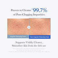 Thumbnail for medicube Zero Pore Clear Blue Capsule Facial Deep Cleanser for Skin Texture, Blackhead & Pore Care | AHA, BHA & PHA for Double Cleansing, Daily Gentle Face Wash, Korean Skincare | 120g / 4.23 oz