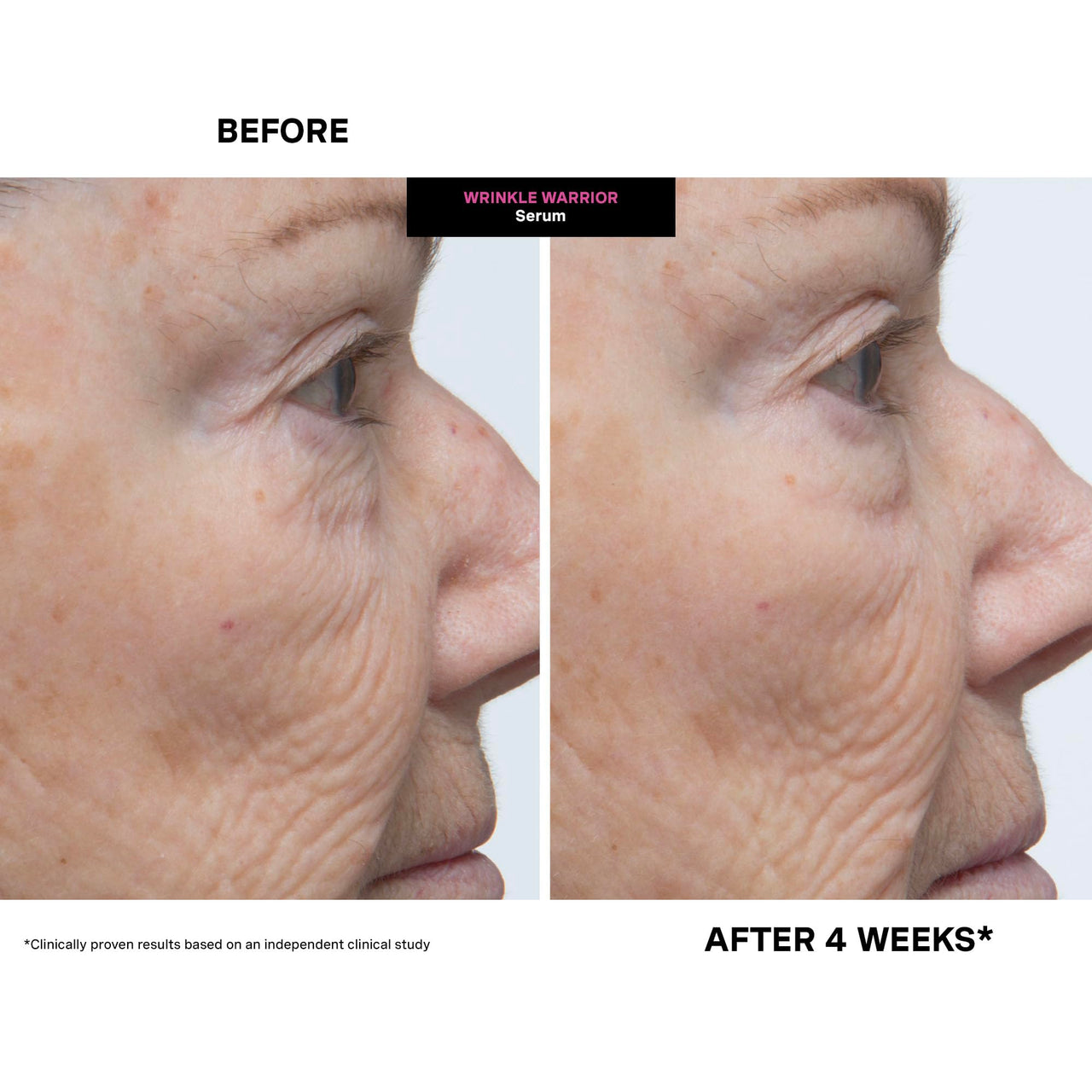 Kate Somerville Wrinkle Warrior | 2-In-1 Plumping Moisturizer + Face Serum | Instantly Hydrates & Smooths Skin | 1.7 Fl Oz