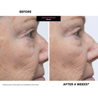 Thumbnail for Kate Somerville Wrinkle Warrior | 2-In-1 Plumping Moisturizer + Face Serum | Instantly Hydrates & Smooths Skin | 1.7 Fl Oz