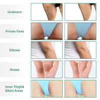 Thumbnail for Vcetree Skin Bleaching Cream Skin Lightening for Body Intimate Areas, Private Parts, Underarm, Knees, Elbows, Inner Thigh, Bikini Area, Whitening Cream Dark Spot Remover For Intimate Areas (1FL OZ)