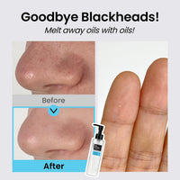 Thumbnail for coxir ULTRA HYALURONIC CLEANSING OIL l Korean Facial Cleanser, Blackhead Makeup Removal with Hyaluronic Acid, Cruelty Free, Hydrating, Smoothing, Calming, Moisturizing [5.07 Fl.oz(pack of 2)]