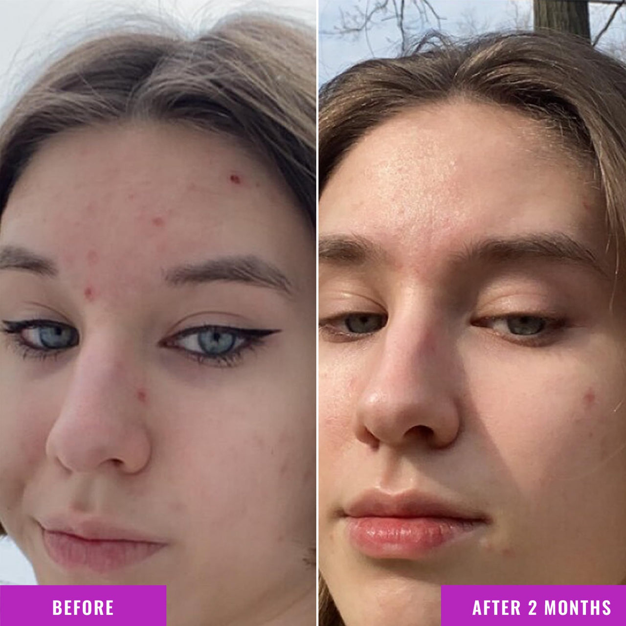 Good Molecules Niacinamide Serum - 10% Niacinamide to Target Blemishes, Nourishment, and Skin Tone - Ultra Hydrating Serum and Brightening Skin Care for Face