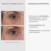 Thumbnail for Murad Targeted Eye Depuffer – Ginseng, Lily, and Caffeine Eye Cream Fights Fatigued and Stressed Appearance by Brightening, Depuffing, and Firming Under-Eye Bags – 0.5 Fl Oz
