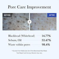 Thumbnail for medicube Zero Pore Blackhead Mud Facial Mask - Skin Cooling & Pore Tightening - 3 Minute Quick Dry Formula with AHA, BHA, PHA, and Pore-Purifying Clay - Korean Mud Mask 3.52 oz