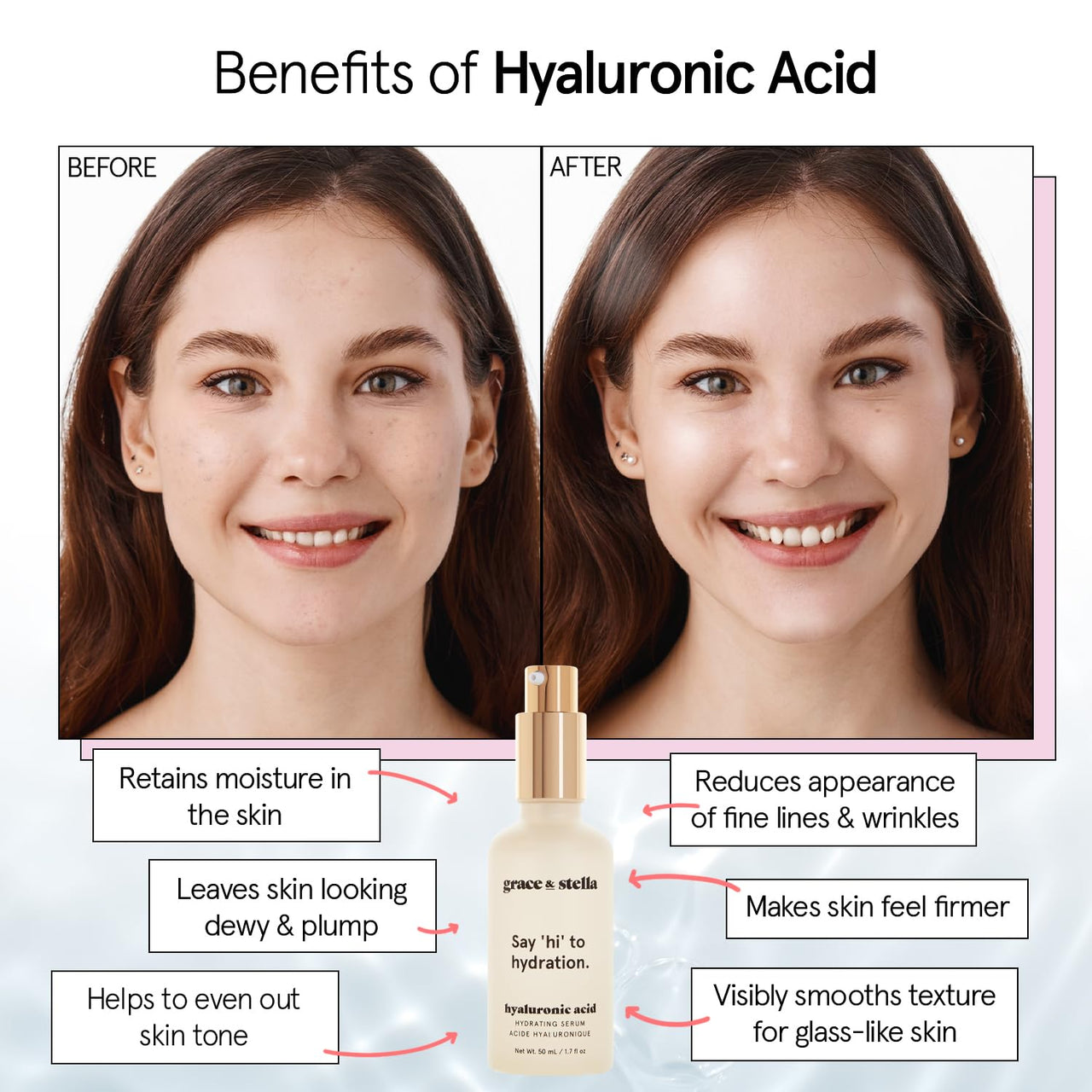 grace & stella Award Winning Hyaluronic Acid Serum (30 ml/1 fl oz) Hyaluronic Acid Serum for Face - Acido Hialuronico Face Serum for Women - Hydrating Serum Remove Fine Lines, Wrinkles - Anti Aging