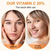 Thumbnail for Premium 20% Vitamin C Serum For Face with Hyaluronic Acid, Retinol & Amino Acids - Boost Skin Collagen,Hydrate & Plump Skin, Anti Aging & Wrinkle Facial Serum 60ml