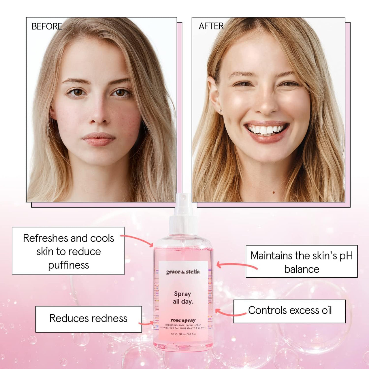 grace & stella Award Winning Rose Water Facial Spray (240ml) - Vegan - Rose Water Spray for Face - Rosewater Spray Toner Rose Hydrosol - Rose Spray Facial Mist - Rosewater Spray Toner Rose Hydrosol