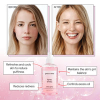 Thumbnail for grace & stella Award Winning Rose Water Facial Spray (240ml) - Vegan - Rose Water Spray for Face - Rosewater Spray Toner Rose Hydrosol - Rose Spray Facial Mist - Rosewater Spray Toner Rose Hydrosol