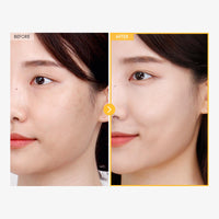 Thumbnail for TOSOWOONG 8 Days Spot Cream, Dark Spot Remover for Face, Age Spot, Sun Spot, Freckles, Melasma, Brown Spot Serum, Advanced Formula Corrector Cream with Niacinamide for Women and Men, 50g, 1.76 oz.