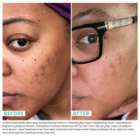 Thumbnail for Super C Brightening Serum